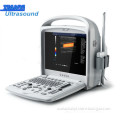 2D Colour Doppler Portable Ultrasound Clinical Equipment